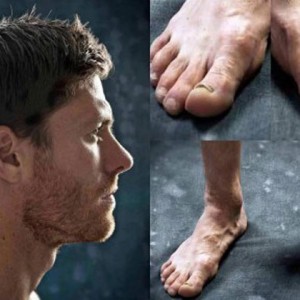 Así terminan los pies de los Futbolistas. Los más feos son los de Ronaldo